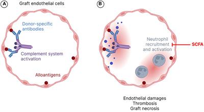 Solid organ transplantation and gut microbiota: a review of the potential immunomodulatory properties of short-chain fatty acids in graft maintenance